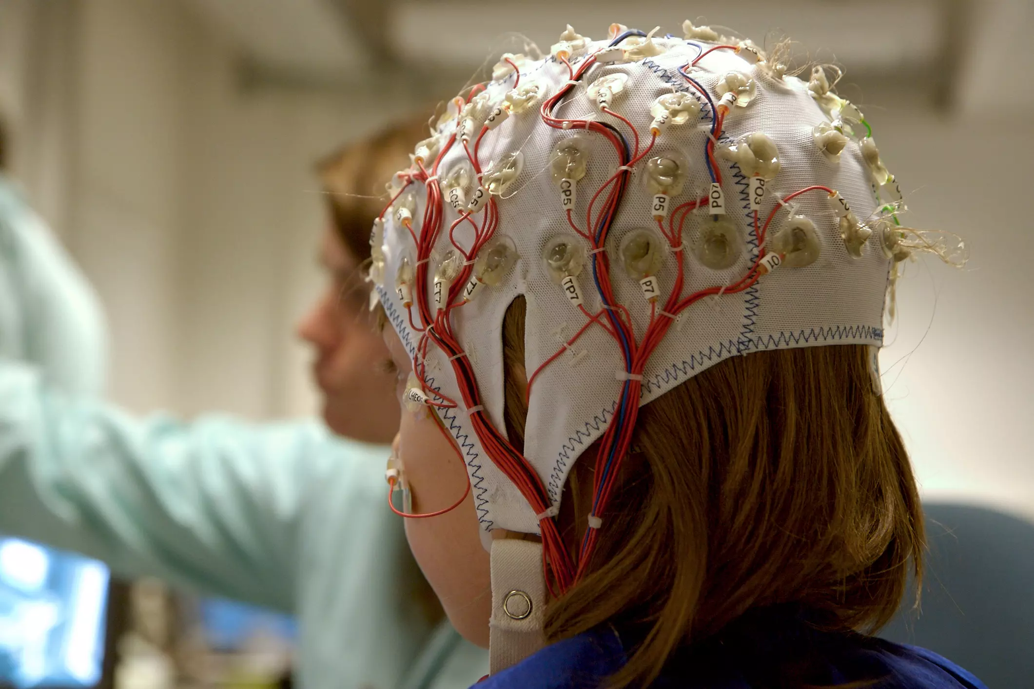 QEEG Brain Map